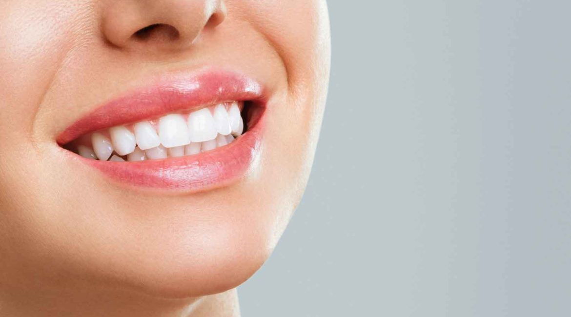 7 tips om tandproblemen te voorkomen